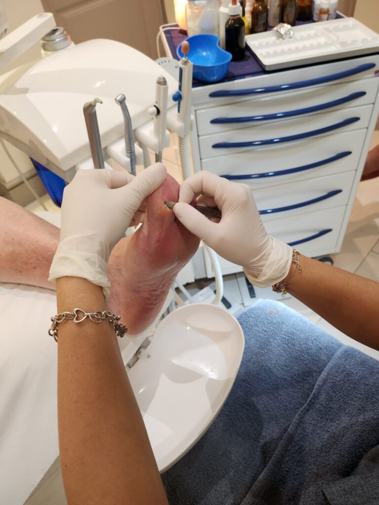 20231017_145905 Visita podologica a Roma Ponte MIlvio