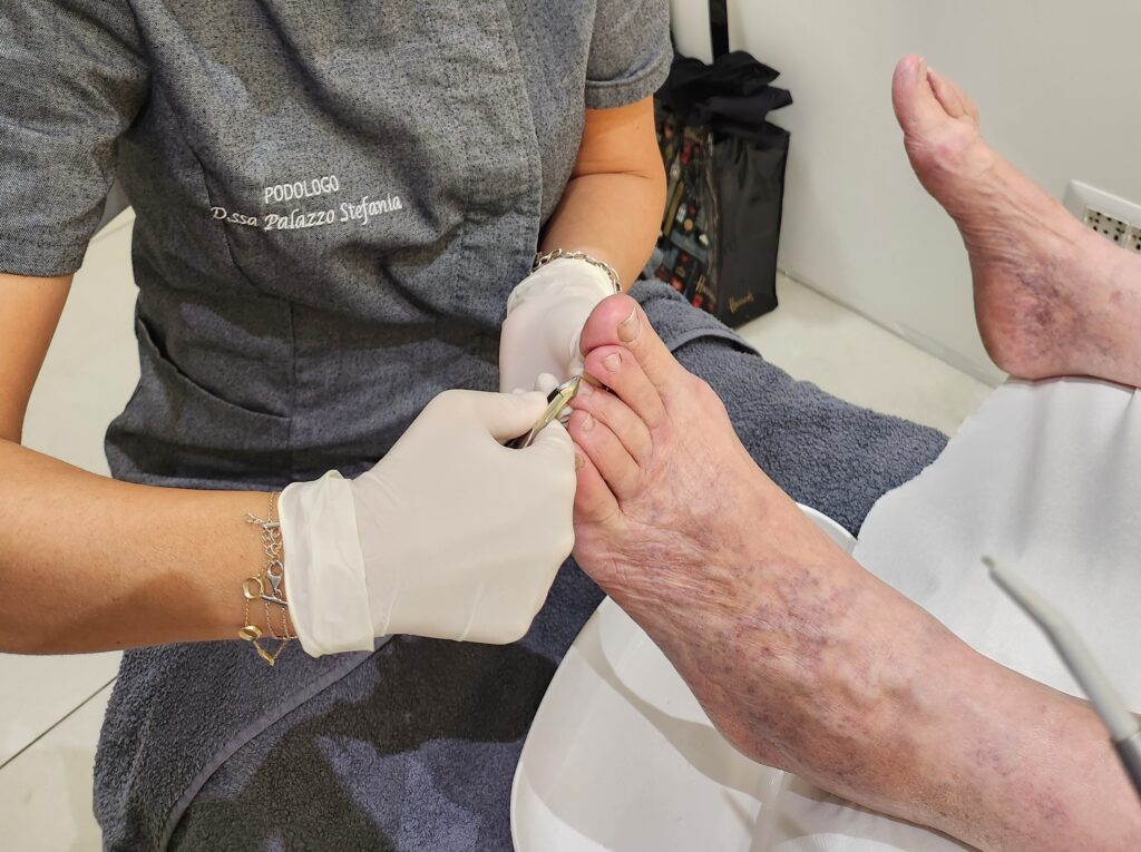 20231017_150025 Podologo per tallonite a Roma Ponte Milvio